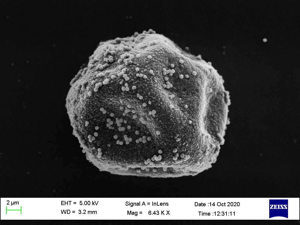 Scanning electron microscopy image of a cypress pollen grain
